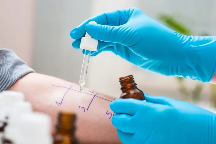 Skin prick allergy testing procedure